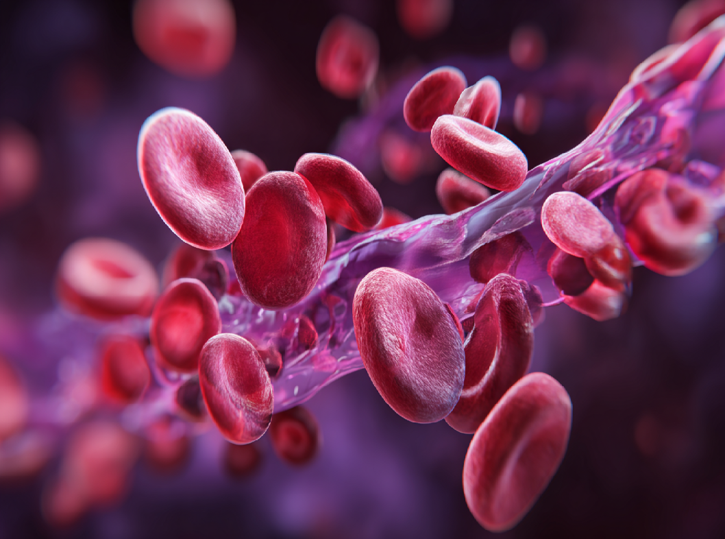 Флеботромбоз