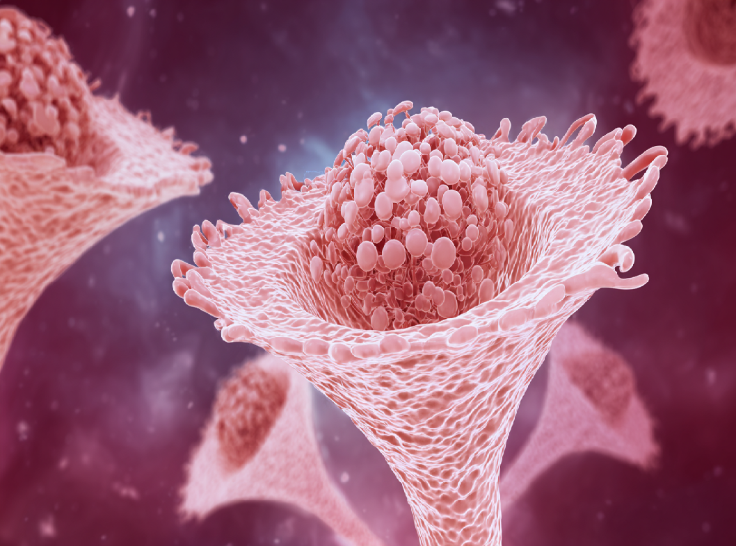 Эрозия шейки матки