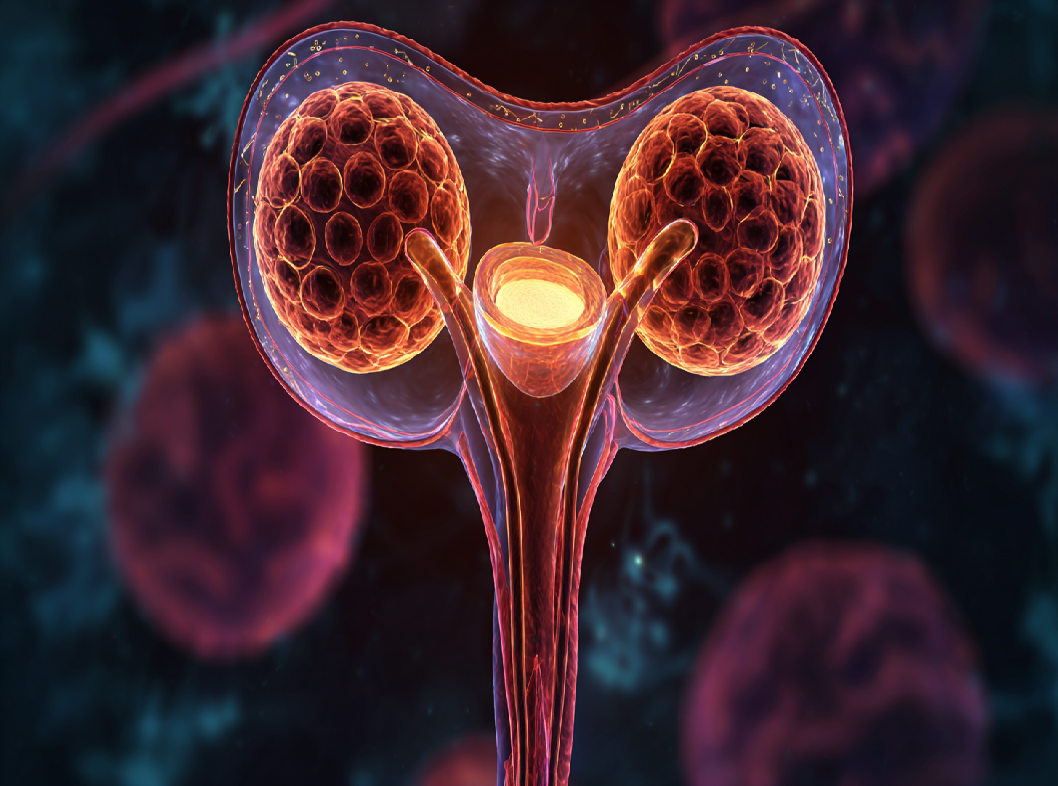 Плоская кондилома шейки матки