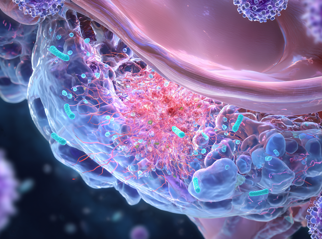 Адгезивный пельвиоперитонит: методы диагностики и лечения