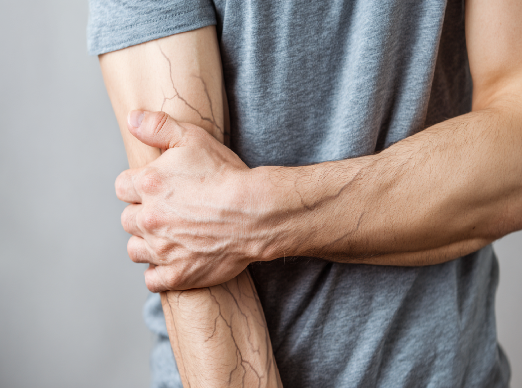 Что делать, если болят вены на руках и к кому обратиться? Arimed