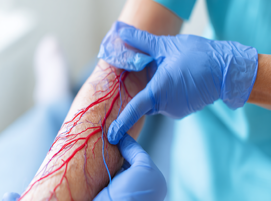 Что делать, если болят вены при коронавирусе?