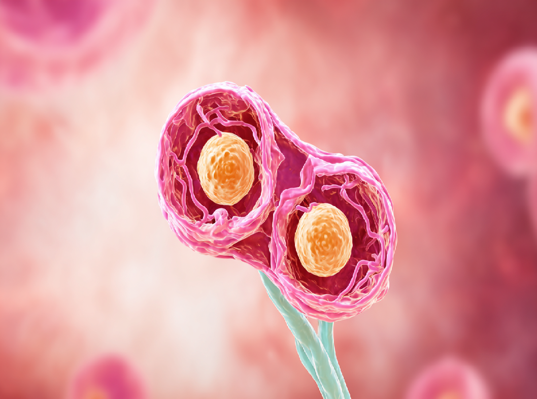 Внутренний генитальный эндометриоз