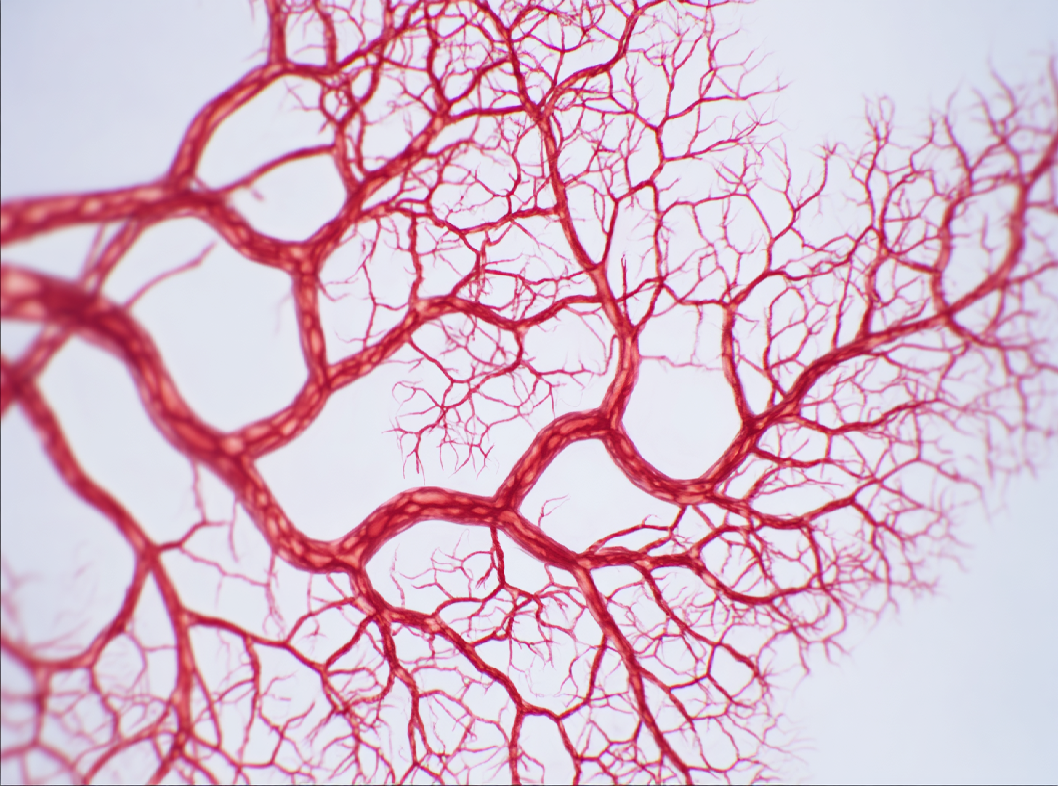 Вегетососудистая дистония