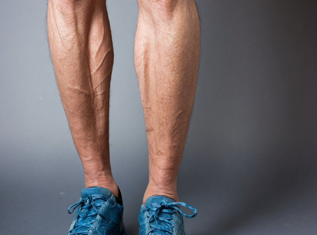 Варикоз Arimed