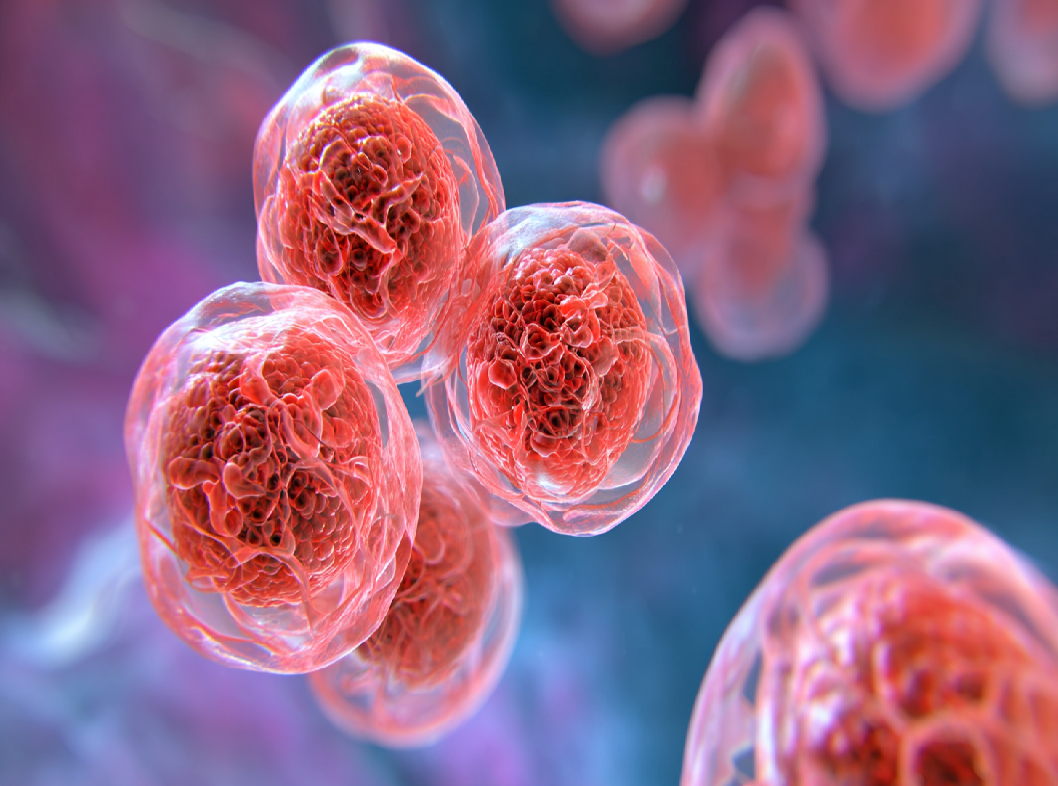 Трихомониаз