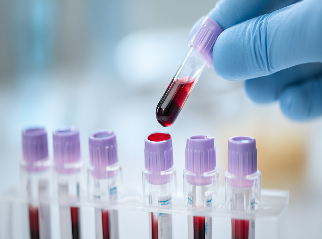 Анализ крови на D-димер