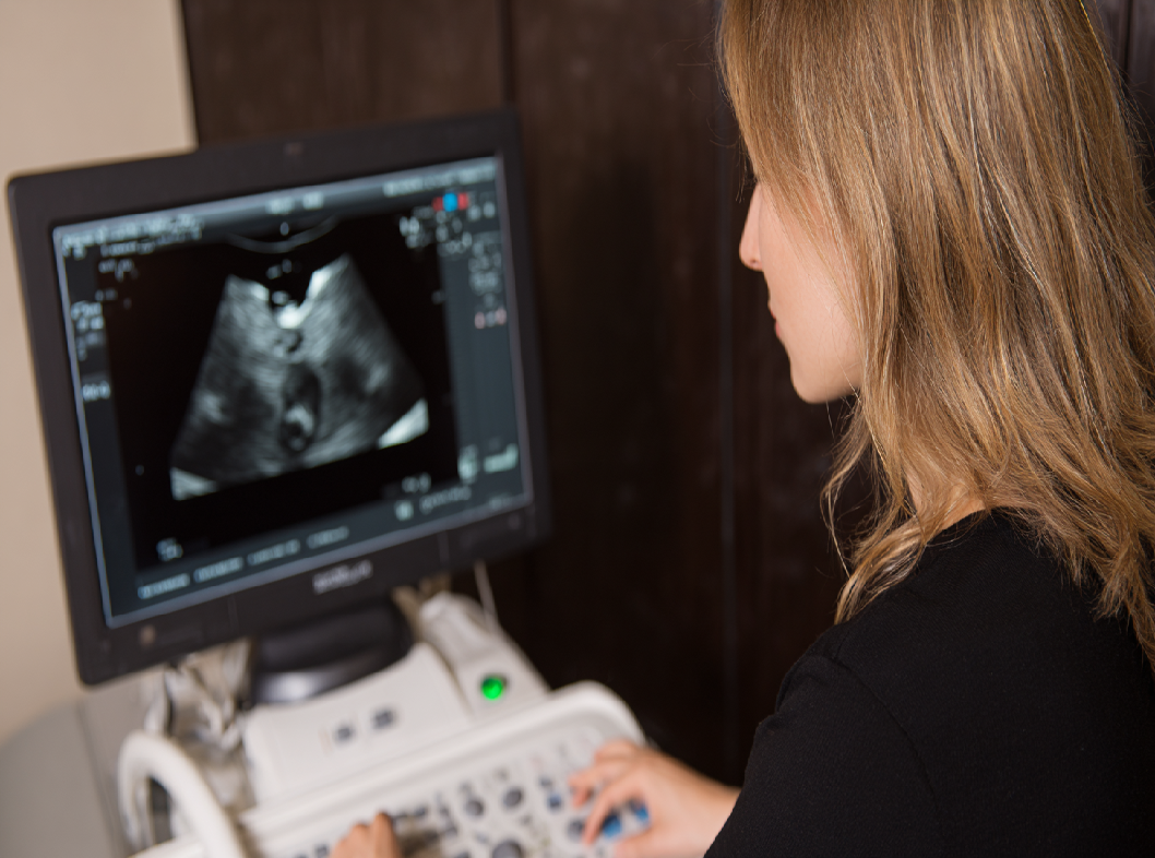 УЗИ органов малого таза