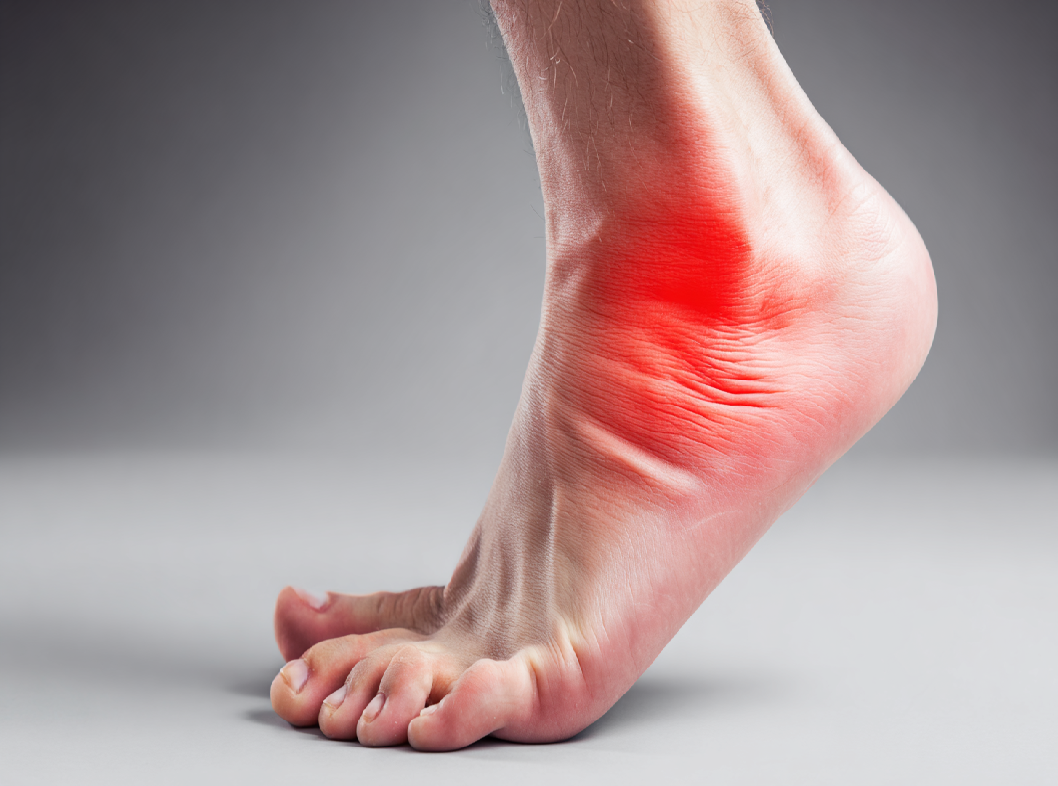 Растяжение связок стопы