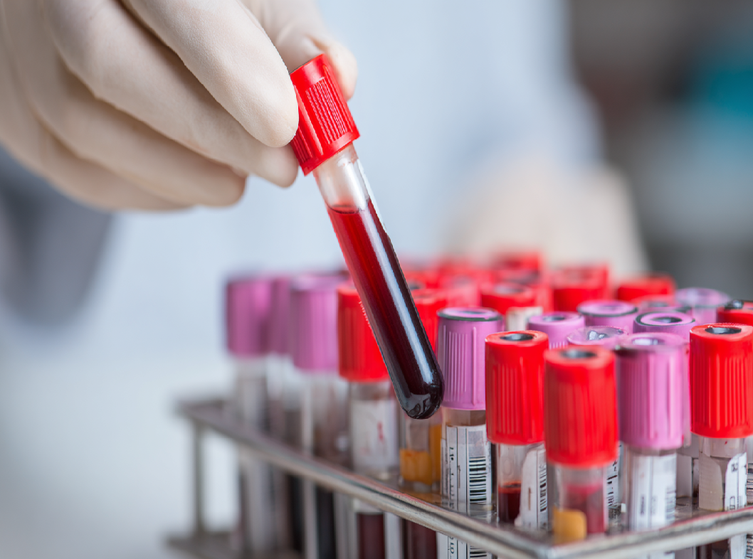 Анализ крови на холестерин