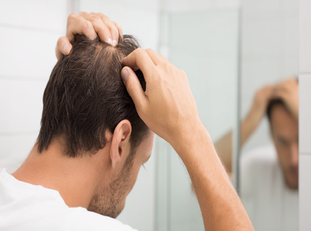 Анализы при выпадении волос