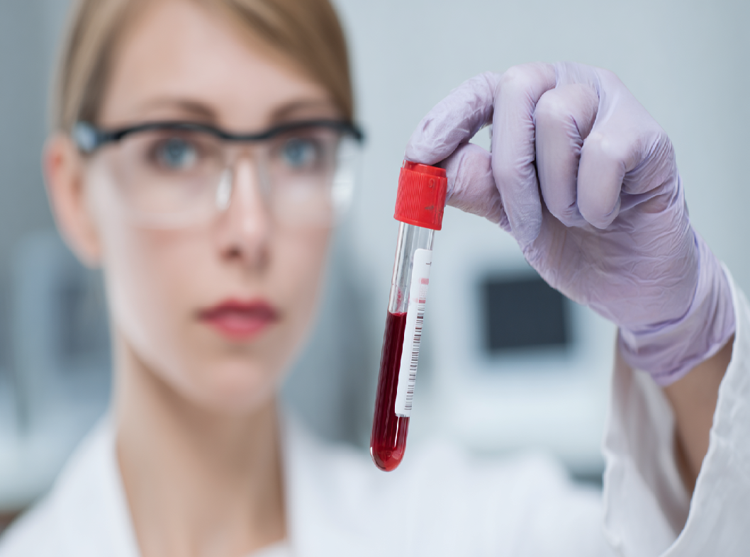 Анализ крови на гормоны