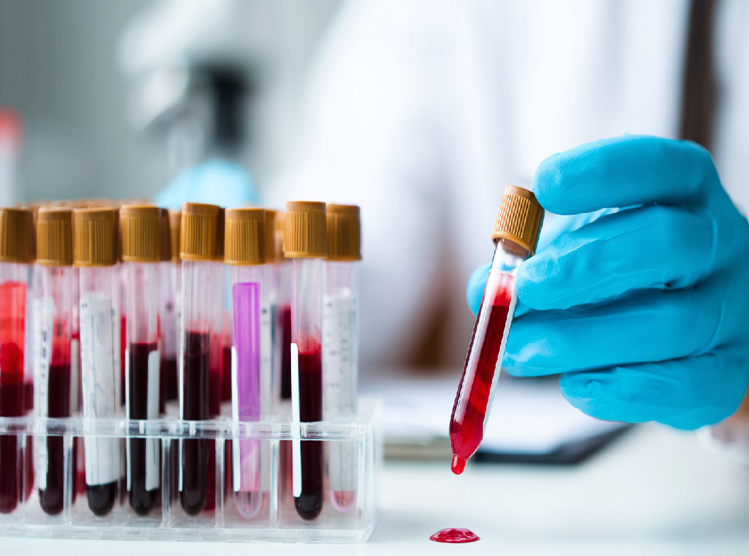 Анализ крови на гормоны