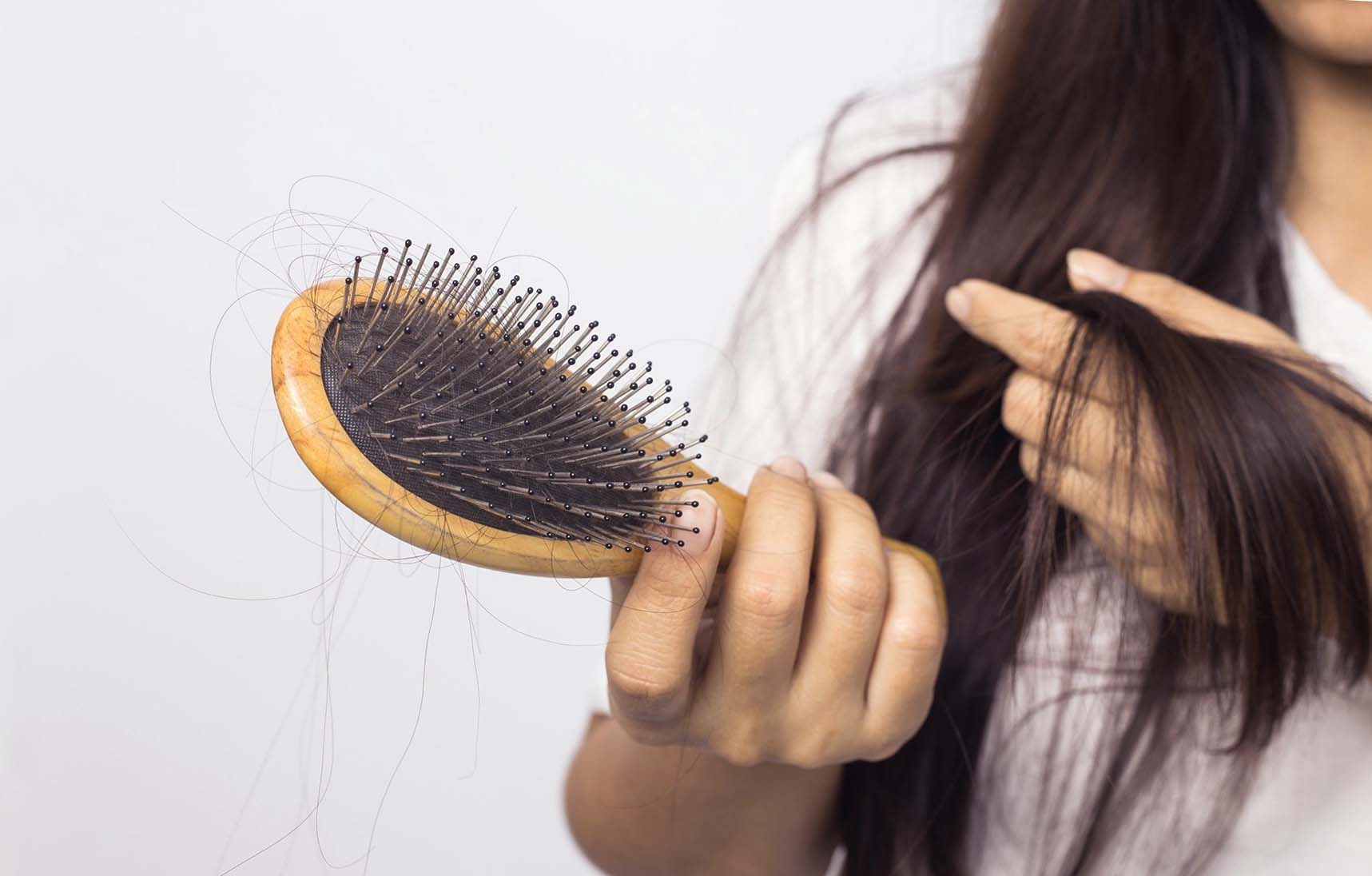 Анализы при выпадении волос