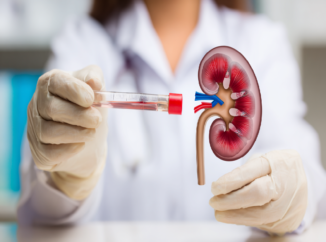 Анализы для проверки здоровья почек