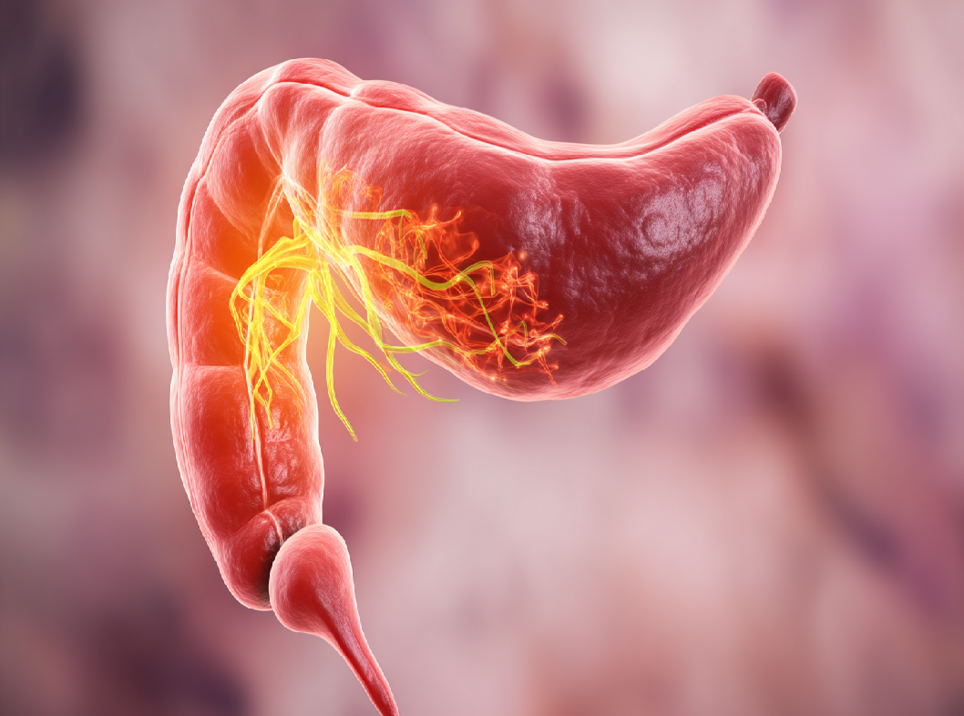 Панкреатит