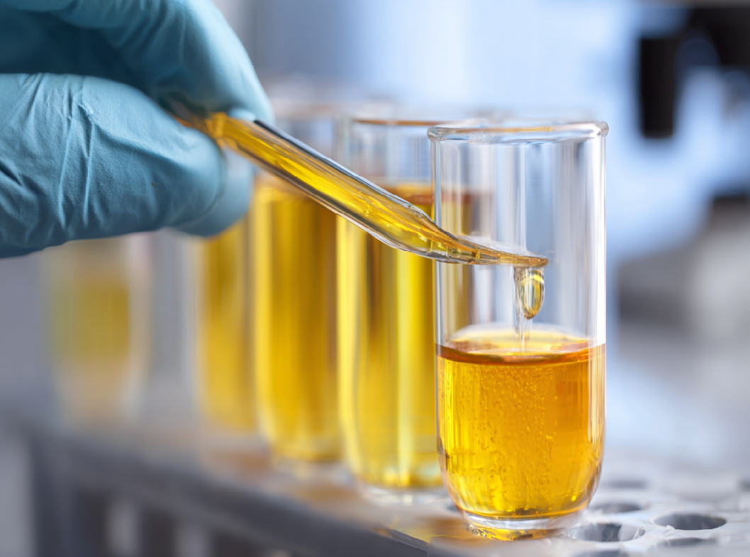 Общий анализ мочи