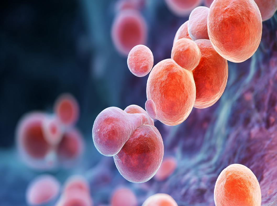 Мочекаменная болезнь