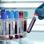 Расшифровка клинического анализа крови Arimed