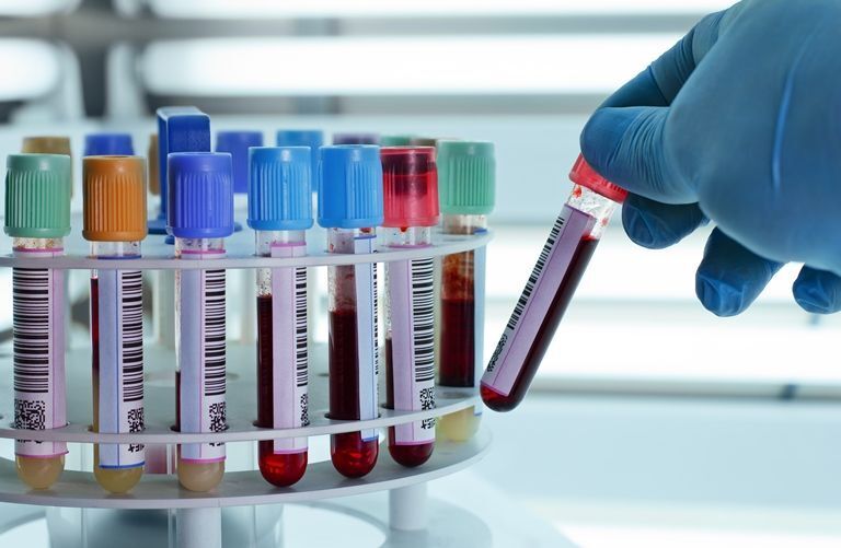 Расшифровка клинического анализа крови