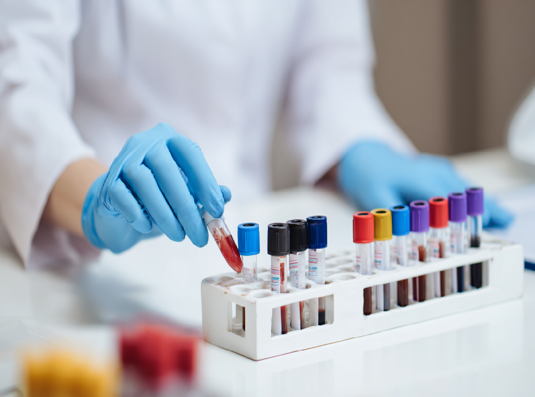 Расшифровка клинического анализа крови