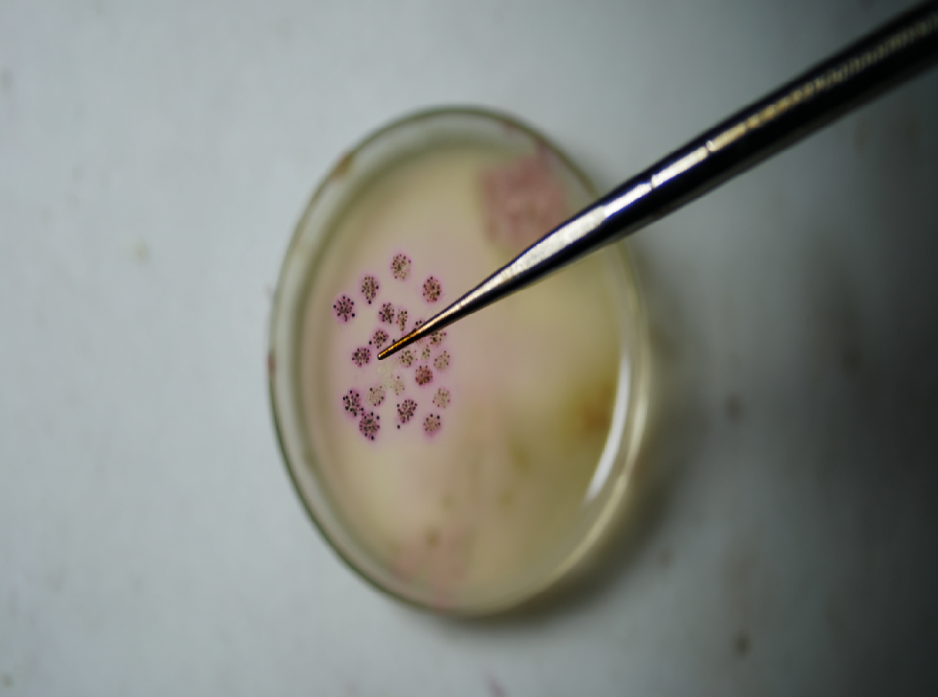 Гинекологический мазок на флору