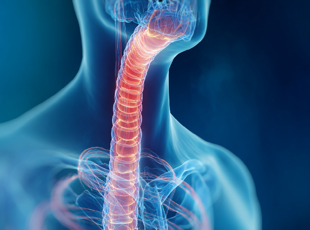 Сужение пищевода