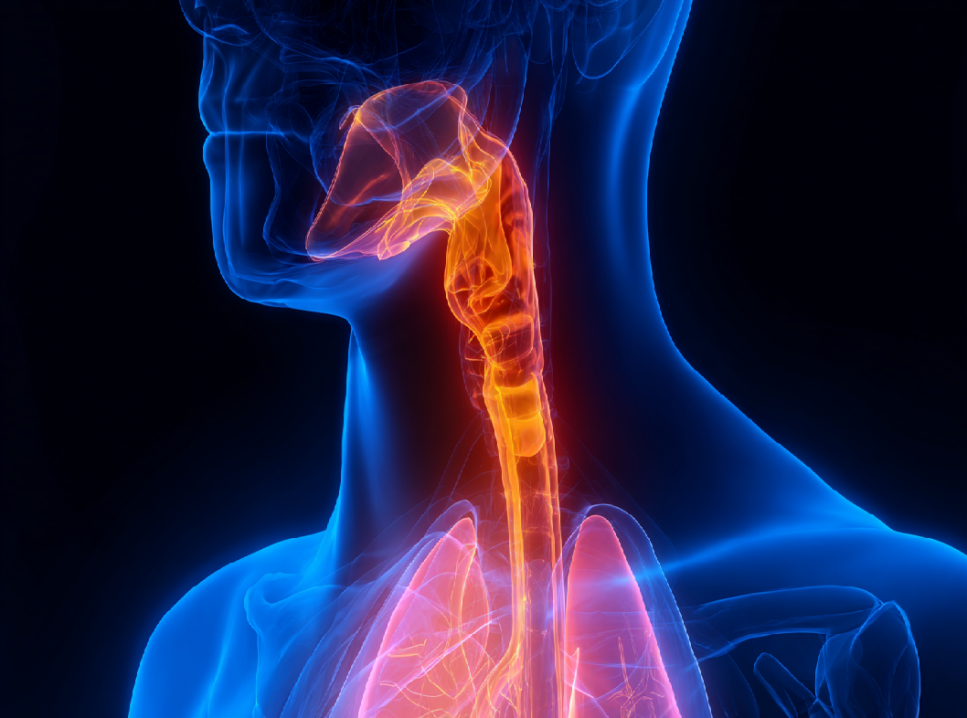 Сужение пищевода