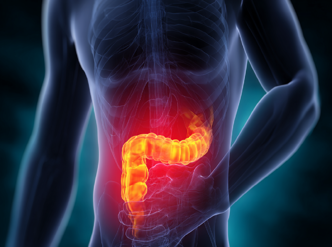 Перитонит Arimed