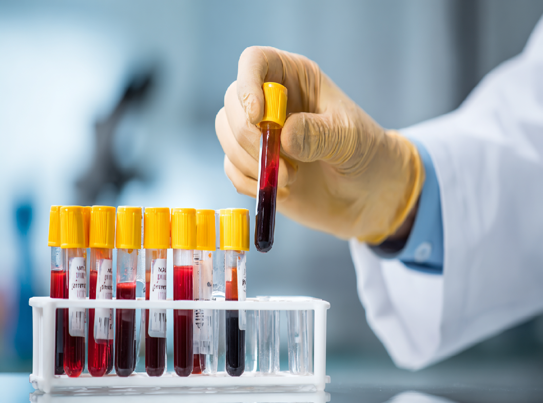 Расшифровка клинического анализа крови