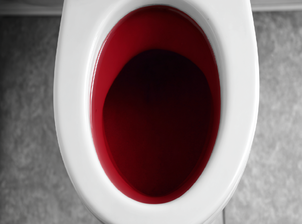 Темная кровь в кале