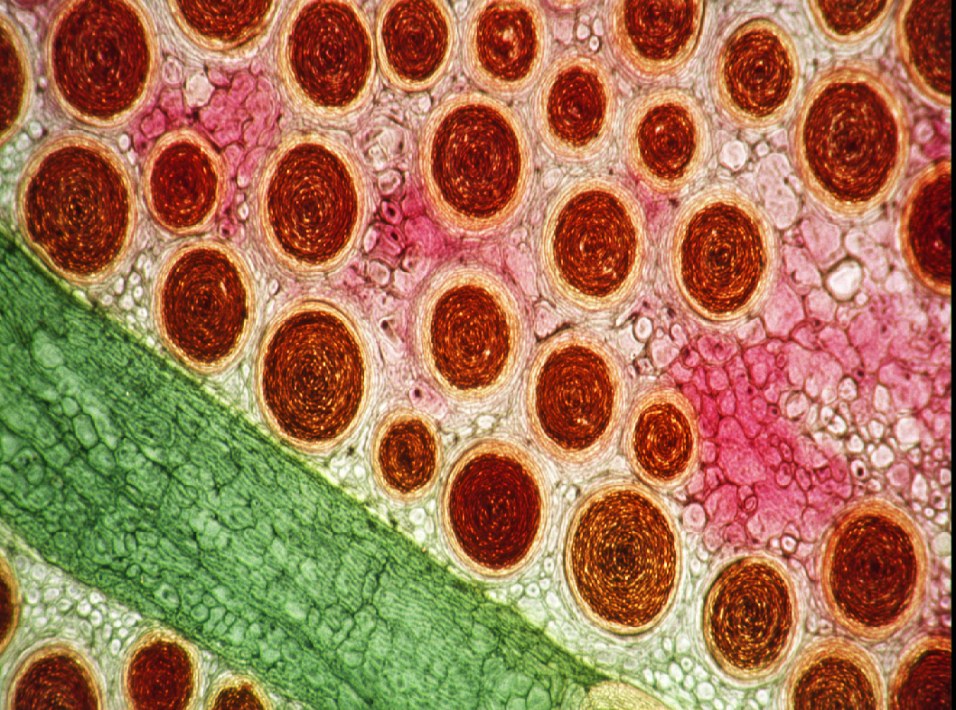 Токсикодермия