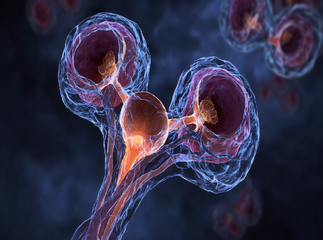 Варикоцеле