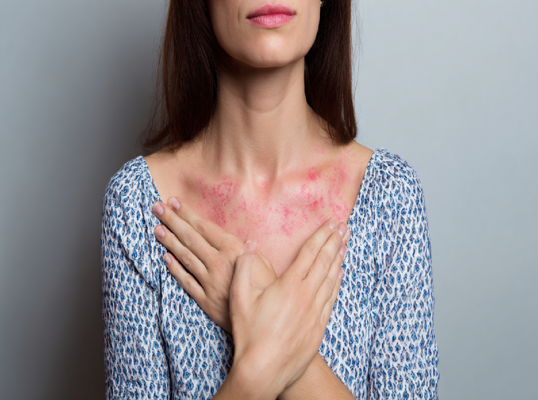 Опоясывающий герпес болезнь