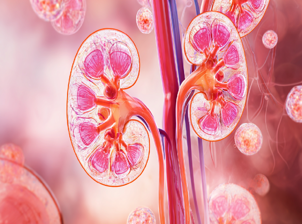 Пиелонефрит