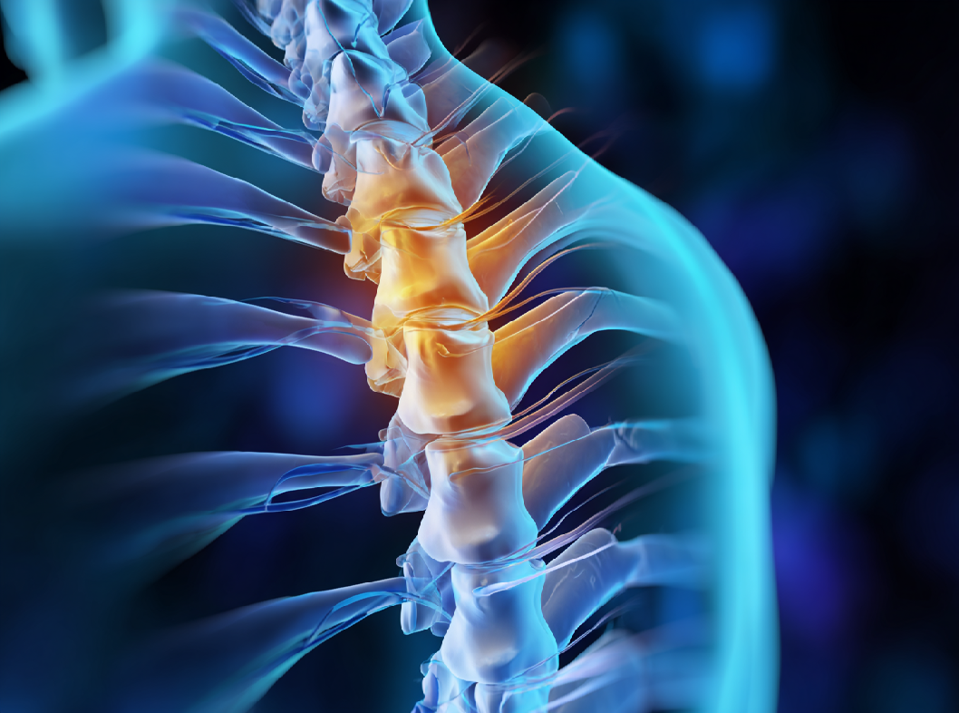 Современные методы лечения позвоночной грыжи Arimed