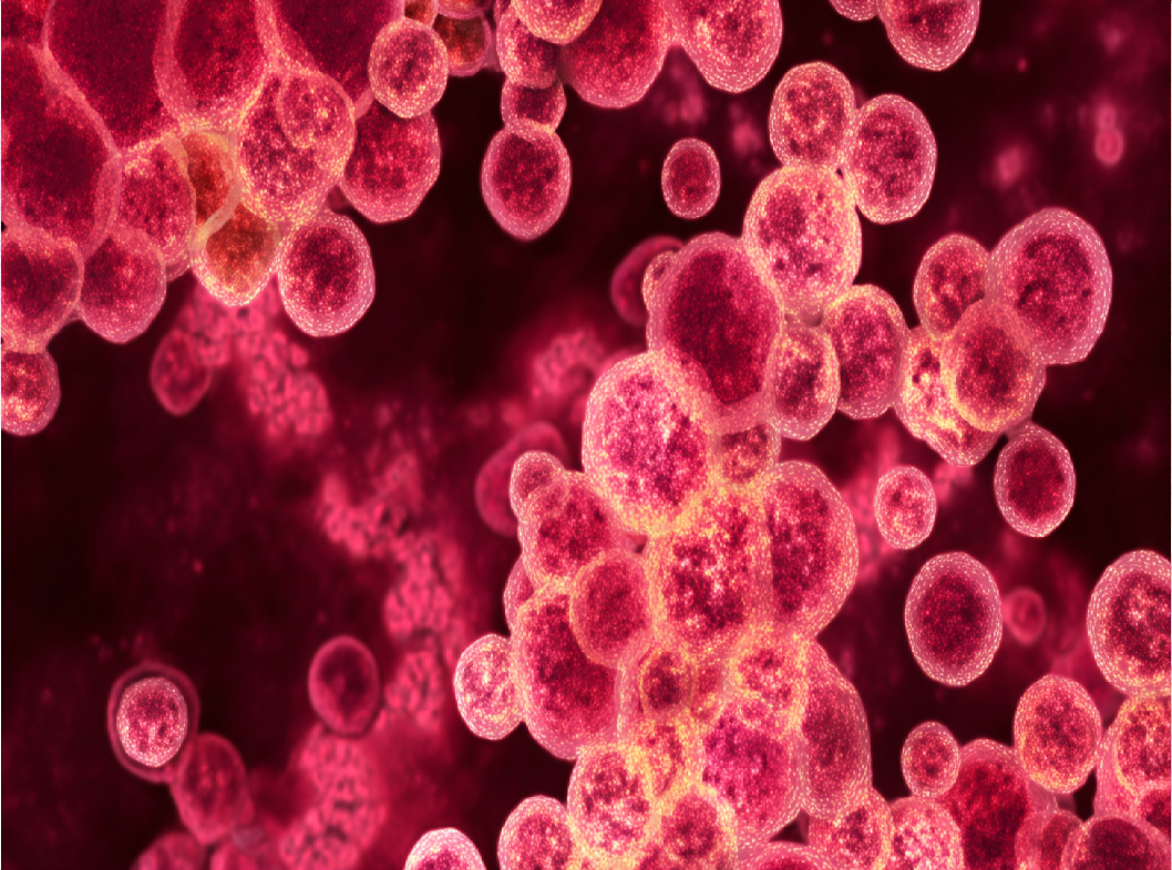 Микоплазменная пневмония