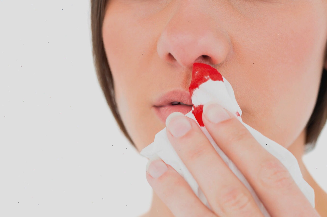 Что делать при носовом кровотечении
