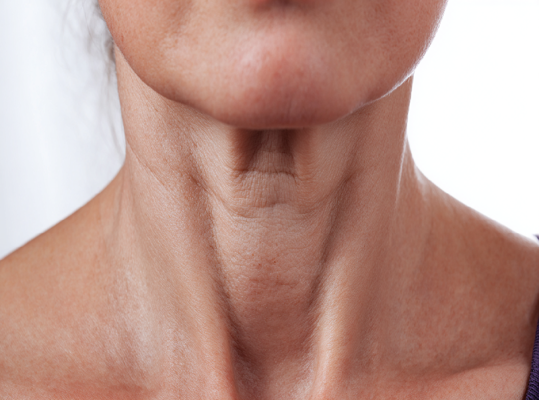 Гипертиреоз