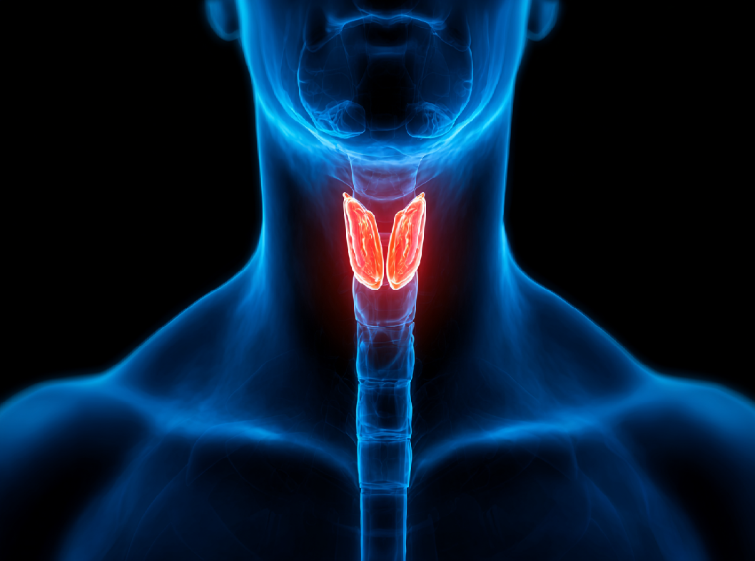 Гипертиреоз