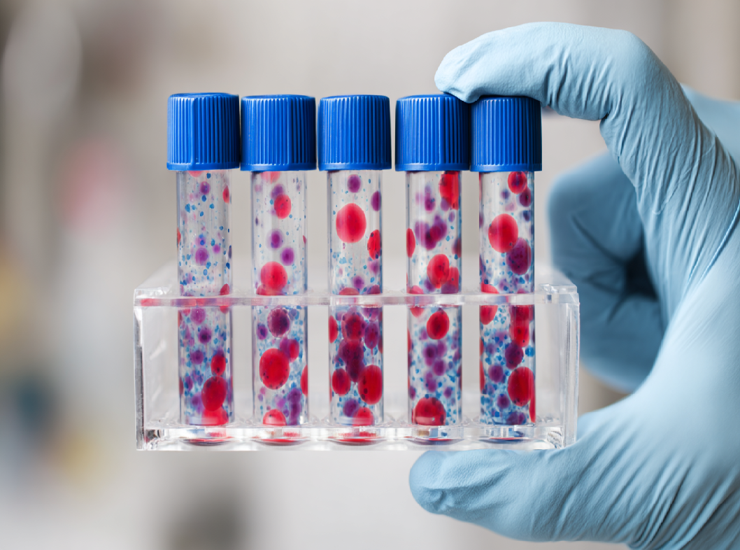 Почему важно сдавать жидкостную цитологию.