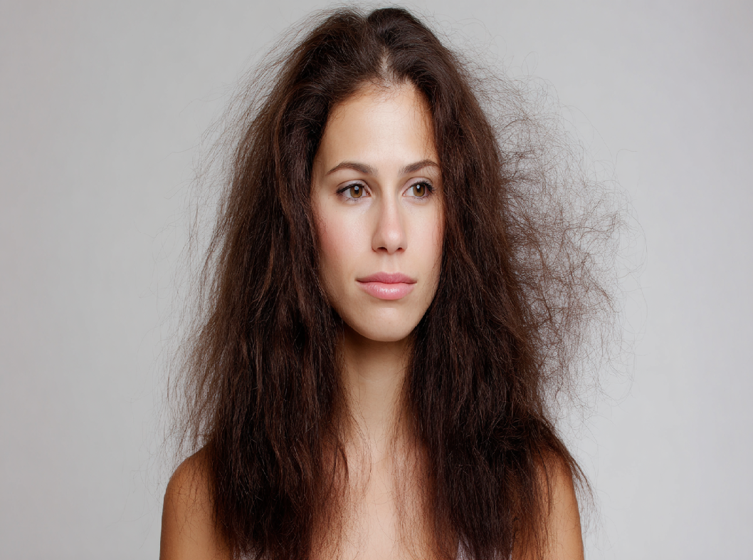 Избыточный рост волос у женщин