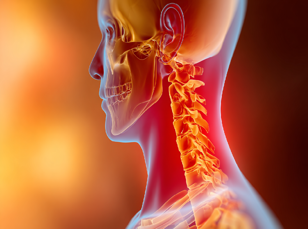 Шейный остеохондроз