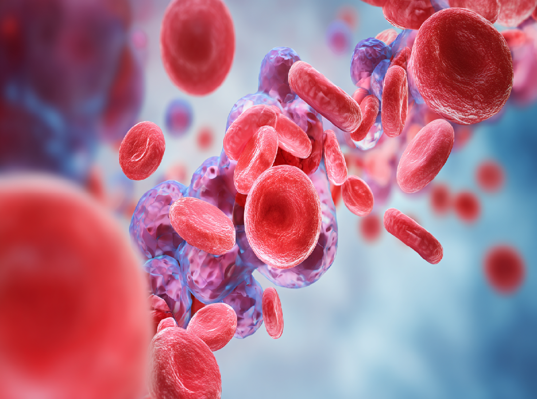 Острая ревматическая лихорадка