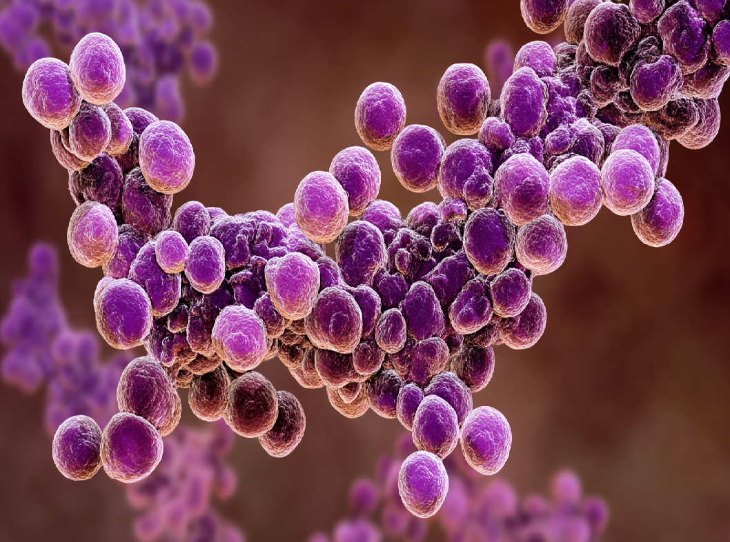 Гломерулонефрит