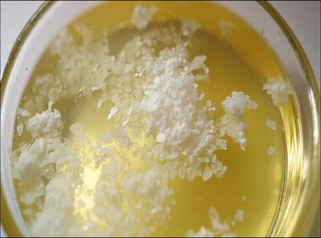 Хлопья в моче