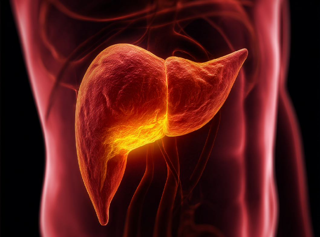 Холецистит