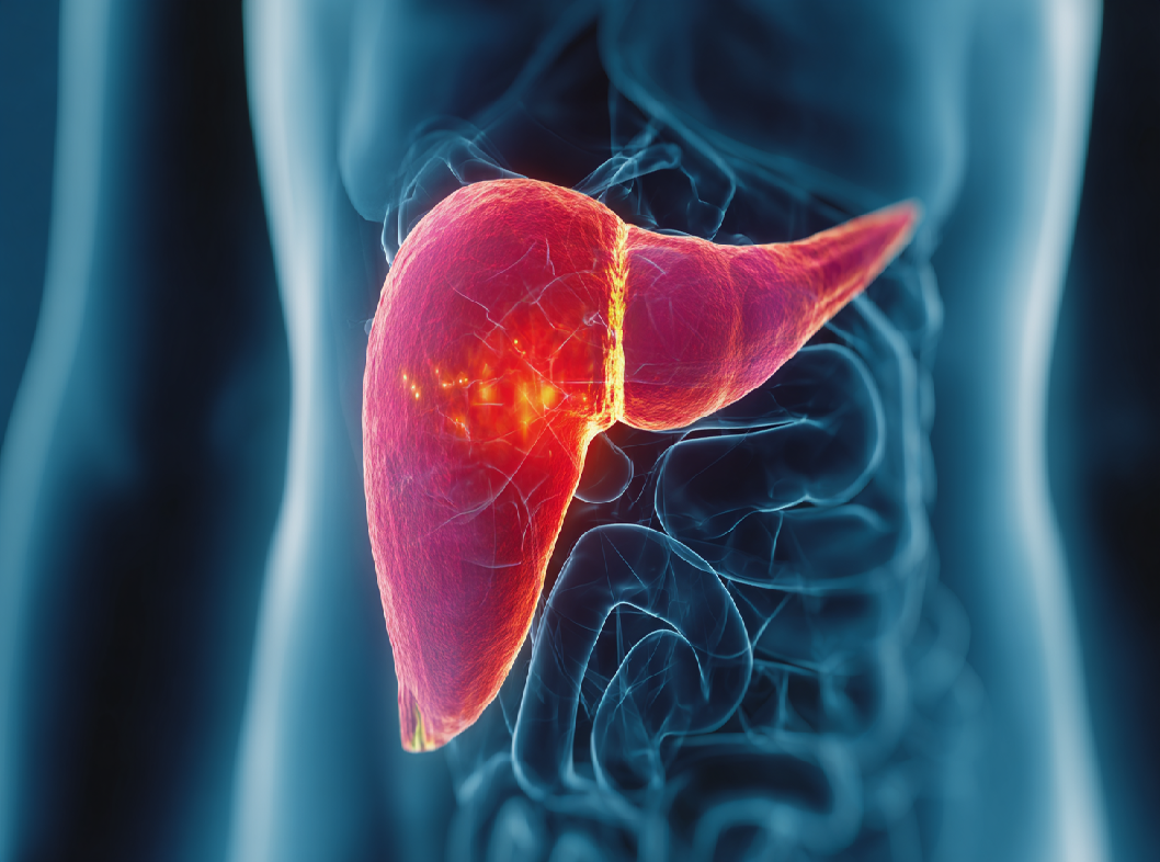 Холецистит