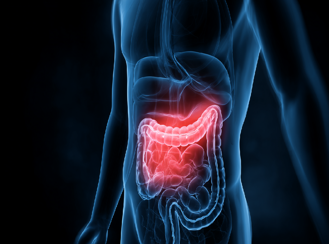 Функциональная диспепсия