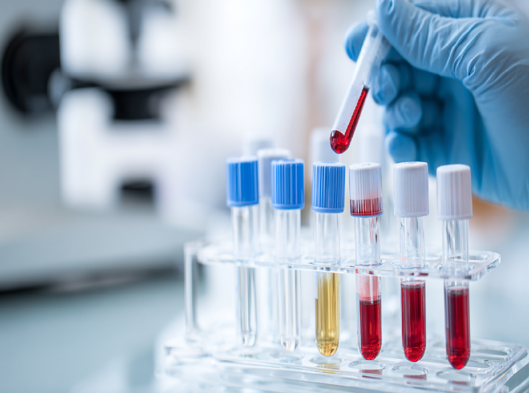 Что показывает анализ на тропонин?